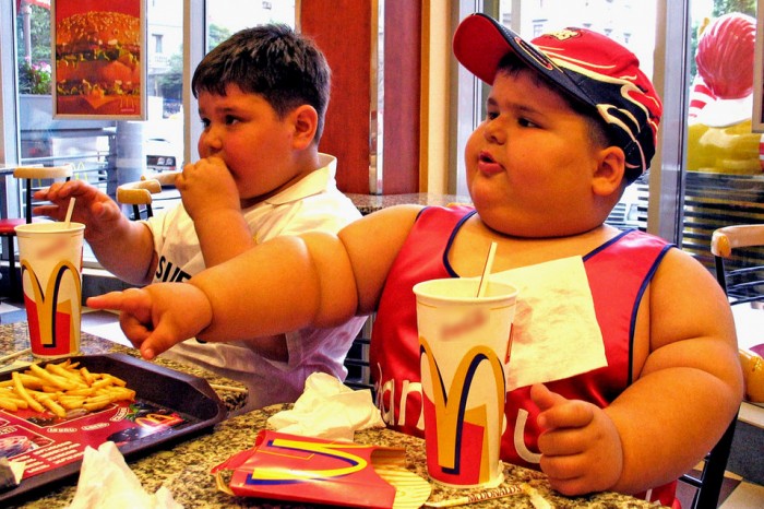 obesidad macdonal